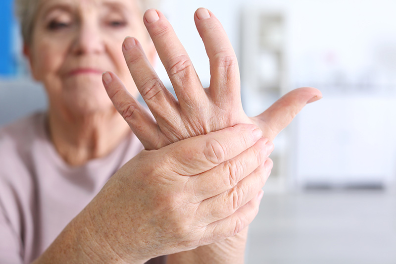 ¿Cómo saber si tengo síntomas de artritis?